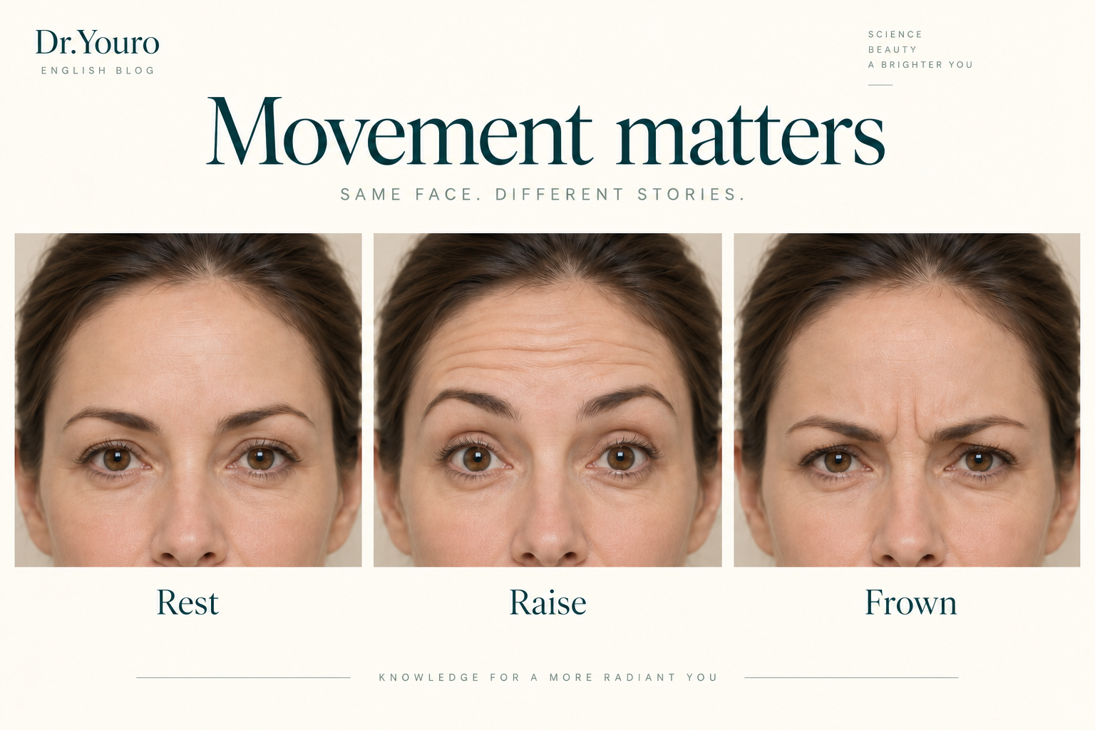 The same illustrative face at rest, raising the eyebrows with horizontal forehead lines, and frowning with lines between the brows.